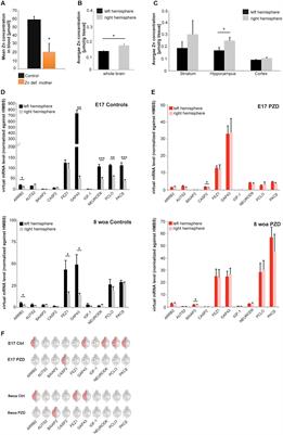 Brain Lateralization in Mice Is Associated with Zinc Signaling and Altered in Prenatal Zinc Deficient Mice That Display Features of Autism Spectrum Disorder